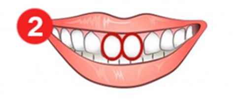 سنكشف اليوم عن حقائق نفسية رائعة حول كيفية تمثيل شكل الأسنان لشخصية الإنسان. استكشفت العديد من الدراسات العلاقة بين شكل الأسنان وشخصيتها.