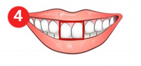 سنكشف اليوم عن حقائق نفسية رائعة حول كيفية تمثيل شكل الأسنان لشخصية الإنسان. استكشفت العديد من الدراسات العلاقة بين شكل الأسنان وشخصيتها.