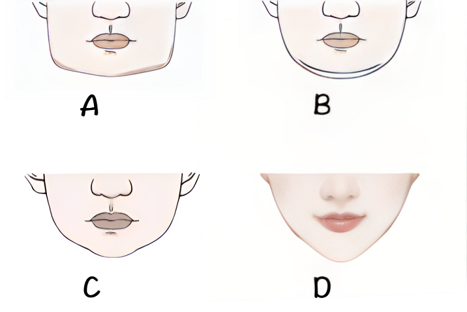 في التشريح، الذقن أو المنطقة العقلية هو آخر جزء من منطقة الوجه تحت الشفة السفلى بما في ذلك بروز الفك السفلي، وهو الذي ينبت عليه شعر اللحية. وهي تتكون من الجزء السفلي من الفك السفلي.