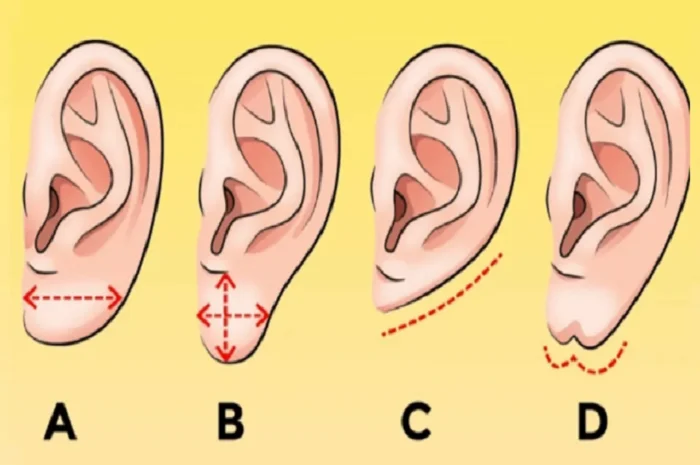وفقًا لاختبارات علم النفس الجسدي ، يمكنك معرفة مدى حظك في الحب من خلال النظر إلى شكل أذنيك. ما هي شحمة أذنك؟