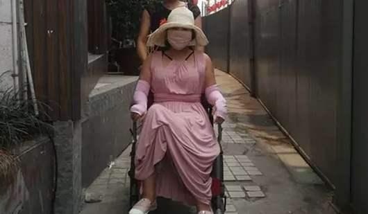 بعد خضوعها لنحو 200 عملية جراحية من بينها تصحيح الوجه بالكامل وتكبير الثدي وتطويل الساق… لم تعد الفتاة الصينية قادرة على المشي بشكل طبيعي.